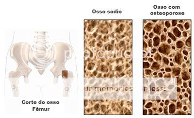 remedios naturales para la menopausia